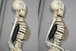 The artificial muscle in use as a bicep lifts a skeleton’s arm to a 90 degree position. Photo: Aslan Miriyev/Columbia Engineering